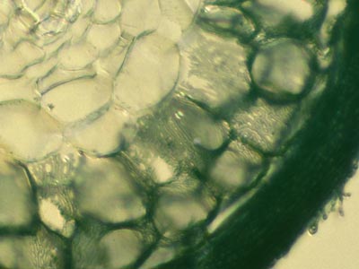 Ectomycorrhizal short roots (15KB)