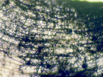  Hyphae on maple root